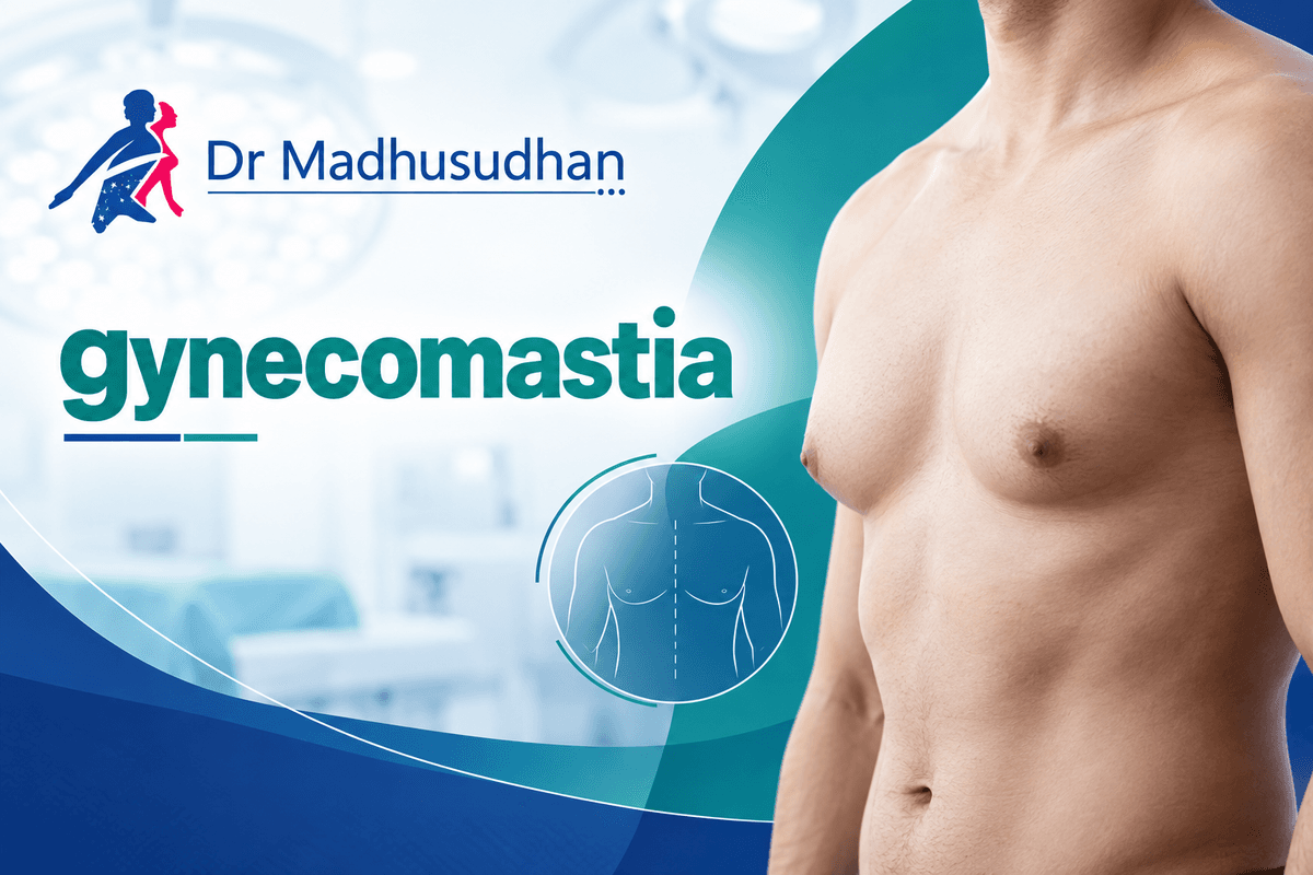 gynecomastia