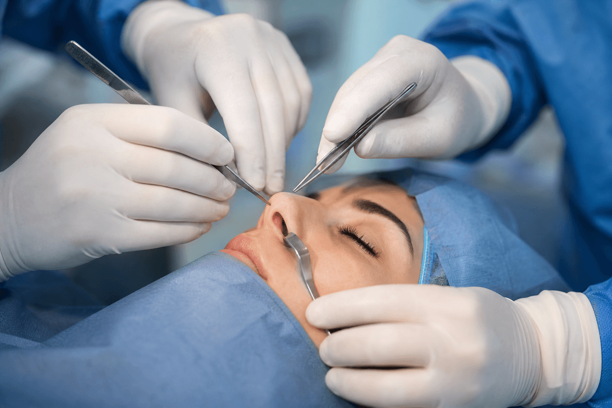 Rhinoplasty