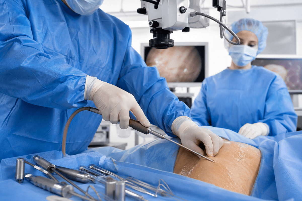 HD Liposuction