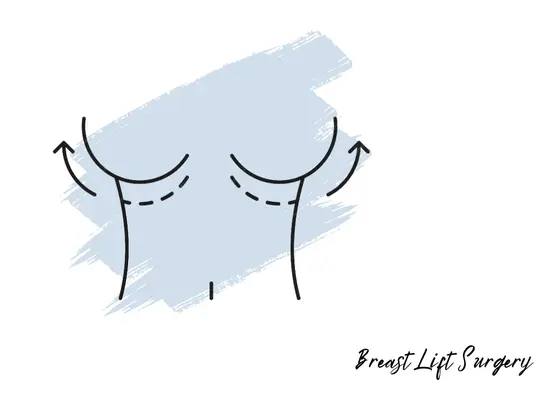 breast-lift-surgery