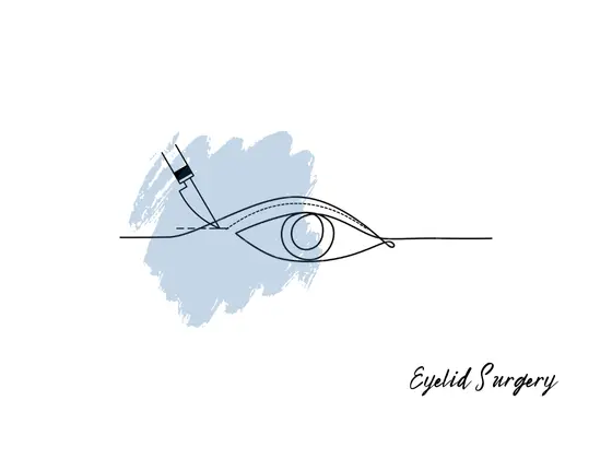 eyelid-surgery