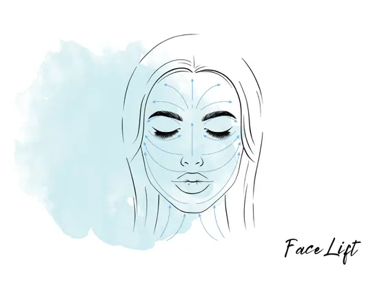 face-lift