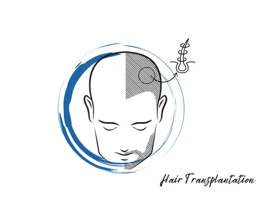 Hair Transplant Surgeon Hair Transplant Surgeon in Gachibowli