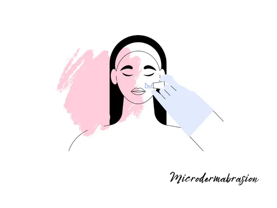 microdermabrasion