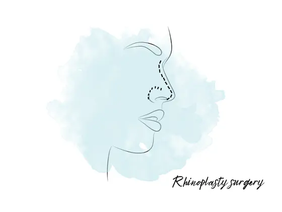 rhinoplasty-surgery