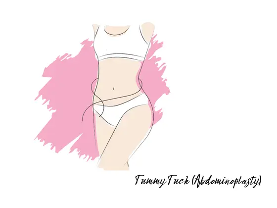 tummy-tuck